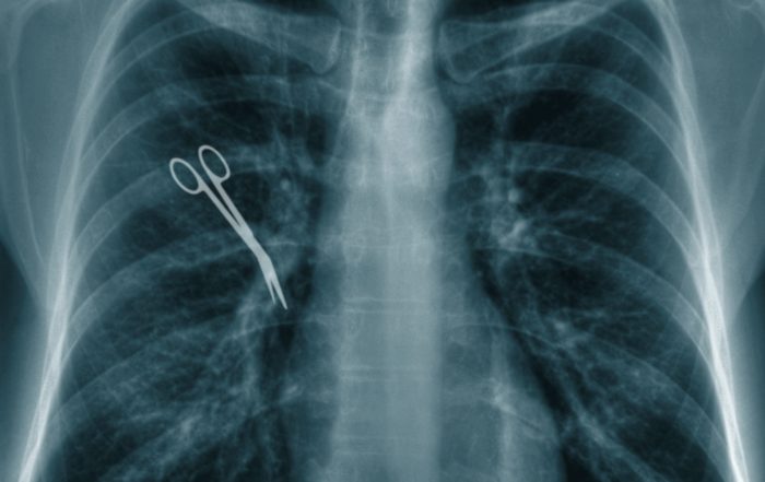 Arzthaftung Schmerzensgeld Mainz Wiesbaden Frankfurt