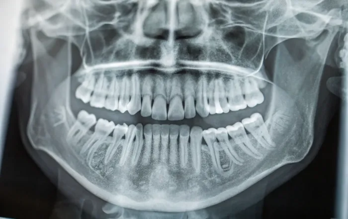 Schmerzensgeld Behandlungsfehler Zahnarzt