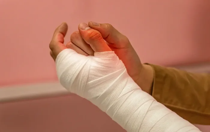 CRPS (Morbus Sudeck) nach Hundebiss